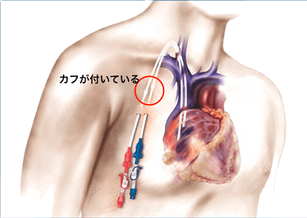 バスキュラーアクセス外来 透析シャント たまき青空病院 徳島市国府町